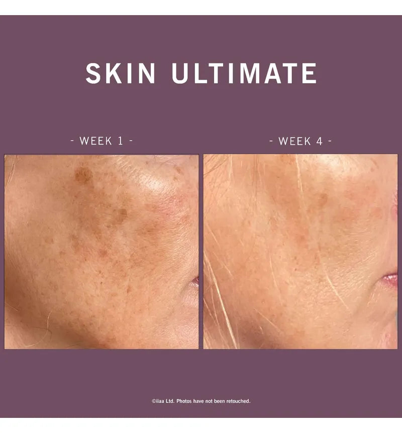 Advanced Nutrition Programme- Skin Ultimate