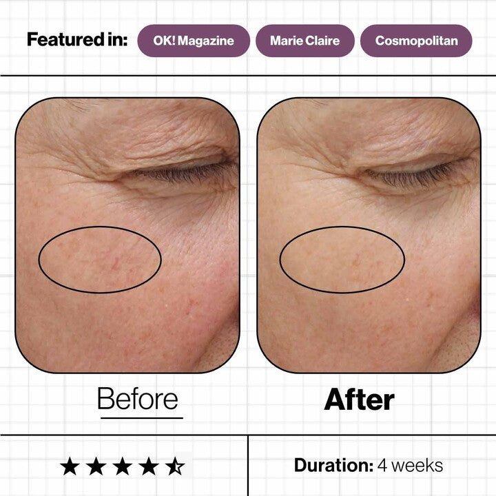 Advanced Nutrition Programme- Skin Ultimate
